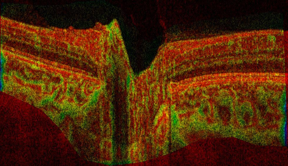 OCT image of a retina