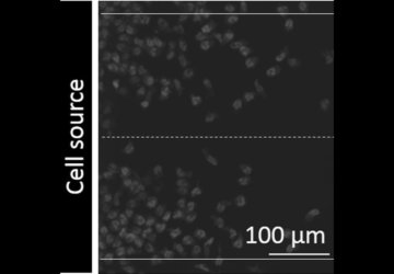 white blood cells on a slide