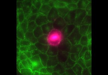 A group of green cells with a central one in magenta