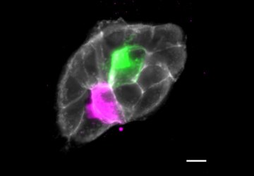 A group of cells with 2 cells colored in green and magenta